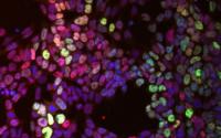 Gene Expression and Cell Decisions Guide Stem Cells