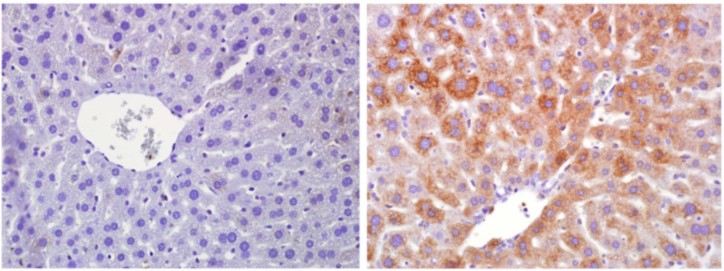 Fasted Mouse Liver Where RagA is Off (left) and On (right)