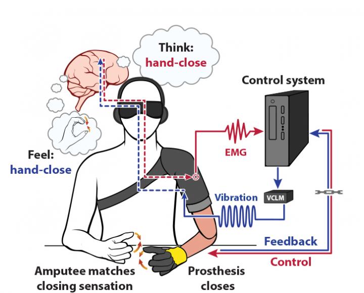 Muscle Vibrations Improve Control Over Prosthetic Hands (1 of 4)