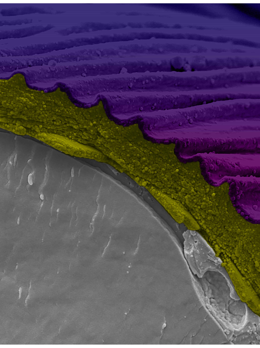 Cryo-Scanning Electron Microscopy of Hibiscus trionum petal fracture