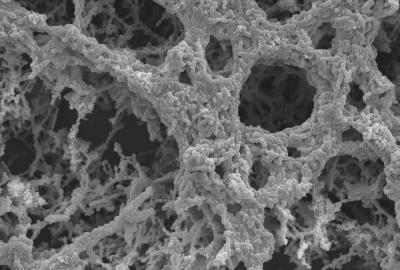 <i>Streptococcus pneumoniae</i> with Black Carbon
