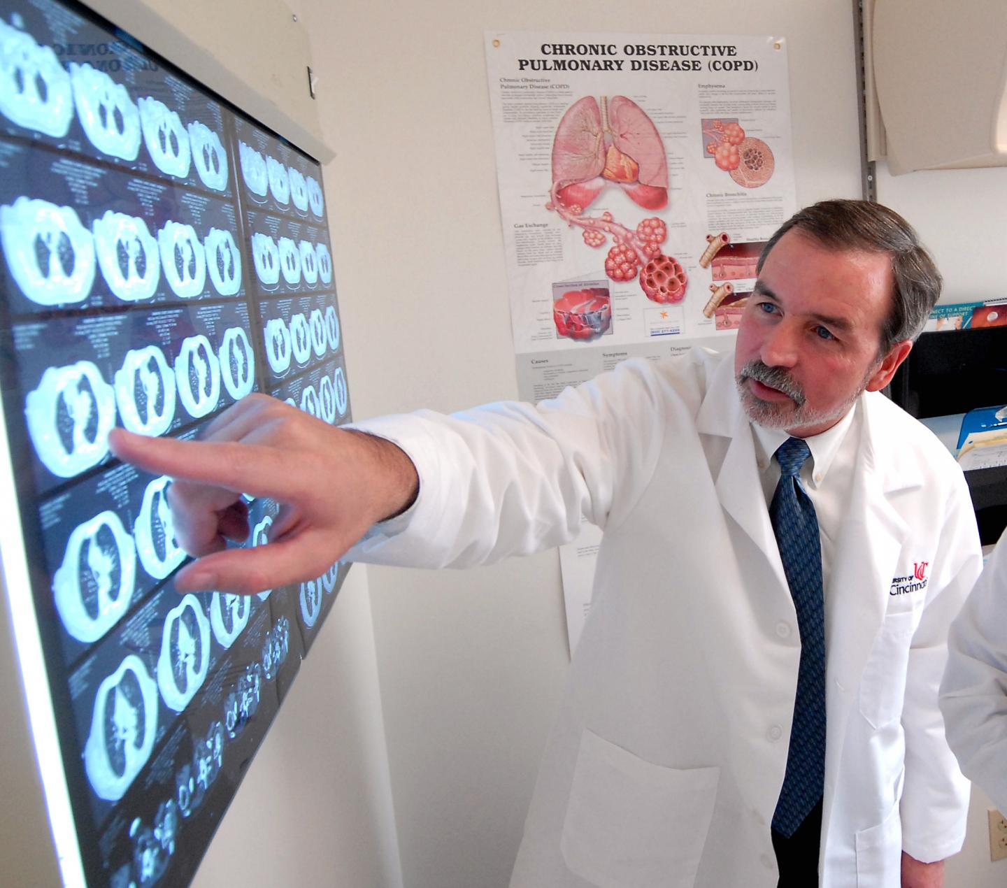 Frank McCormack, University of Cincinnati Academic Health Center