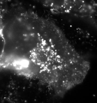 Epi-fluorescence Microscopy Image