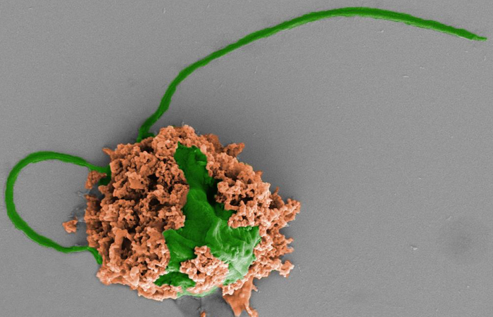 Mikrorobotlar farelerde ölümcül pnömoniyi tedavi ediyor