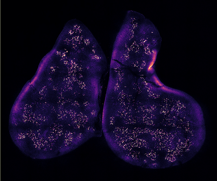 Thymus gland, the birthplace and training camp for T cells