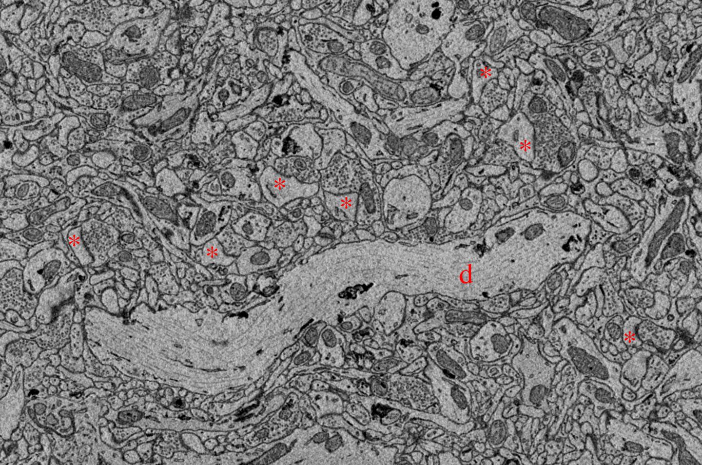 A Peek at the Nightlife of Synapses Reveals They Weaken, and Why (4 of 4)