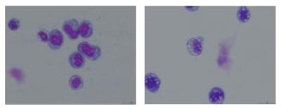 Blocking JAK1 Signaling Slows AML Growth