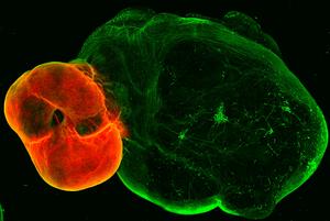 Dopaminergic neurons in brain organoids.