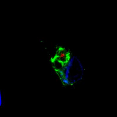 Repeat Proteins Tied to Neurodegeneration (1 of 3)