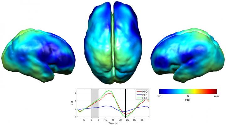 Reconstructed Diffuse Optical Tomography Images