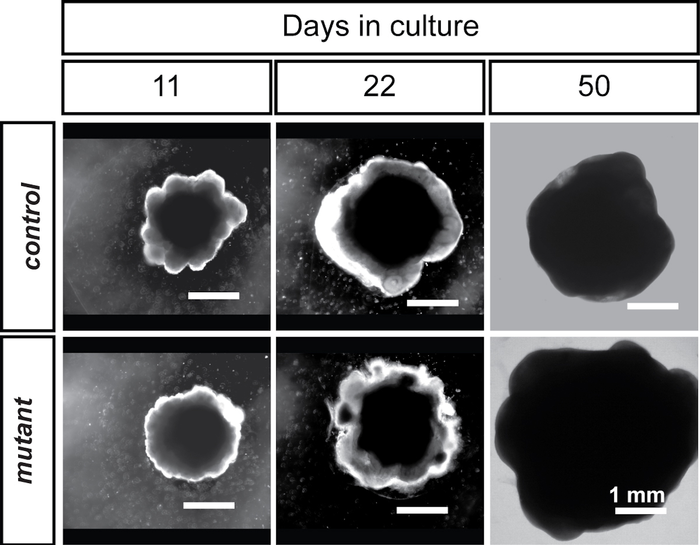 Organoid development.