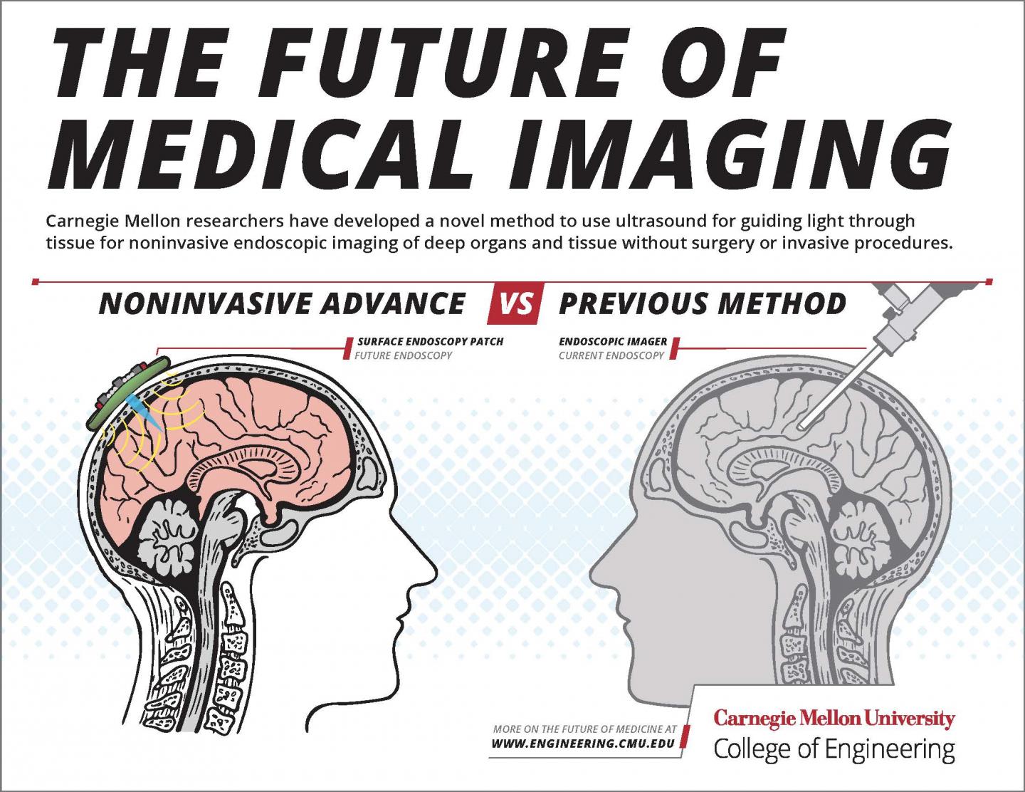 Brain Endoscopy Methods