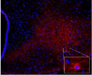 A Broken Calorie Sensing Pathway: How Overeating May Lead to More Eating