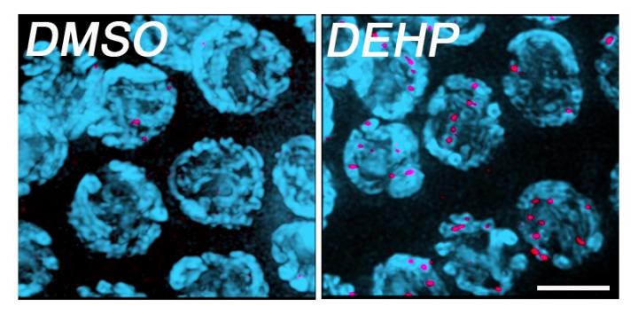 Common <em>C. elegans</em> Plasticizer Disrupts Egg Production