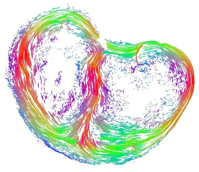Cross Sectional View of the Heart 128 Days into Pregnancy