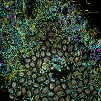 Another microbial community on the surface of kelp.