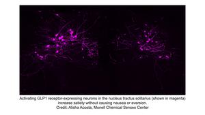 GLP1 receptor-expressing neurons