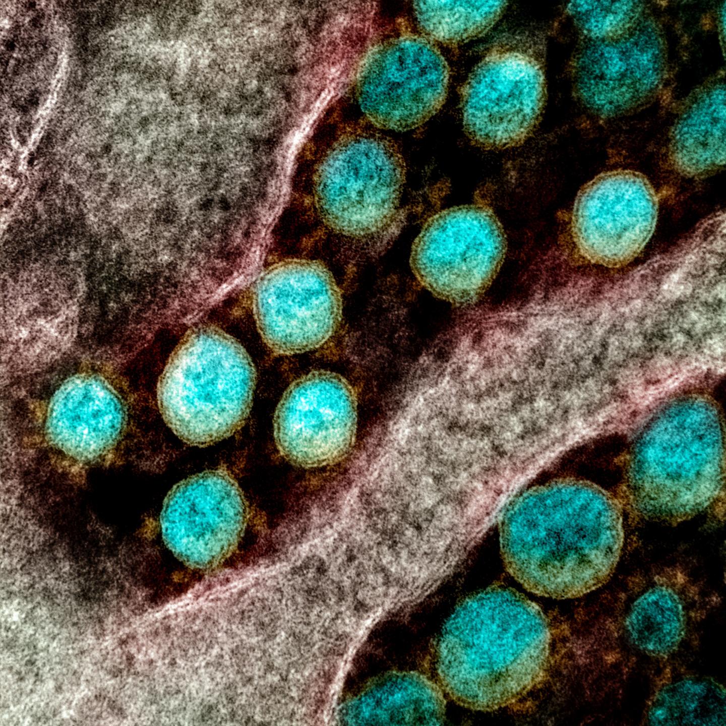 SARS-CoV-2 Virus Particles