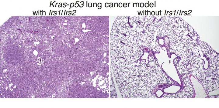 Insulin-IGF-1 Signaling and Lung Cancer