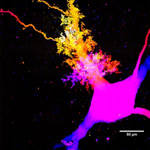 Postsynaptic structures on human hippocampal neuron