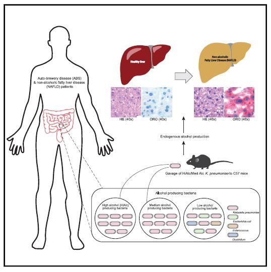 Non-Alcoholic Fatty Live Disease Graphical Abstract