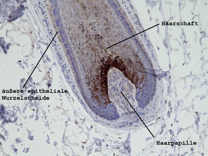 Picture of a Hair Growing inside the Scalp