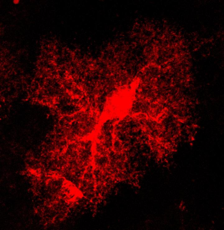 Astrocyte