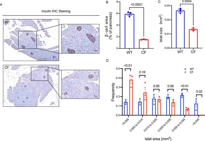 Morphometric analysis of pancreatic islets in wild-type (WT) rabbits and rabbits with cystic fibrosis (CF)