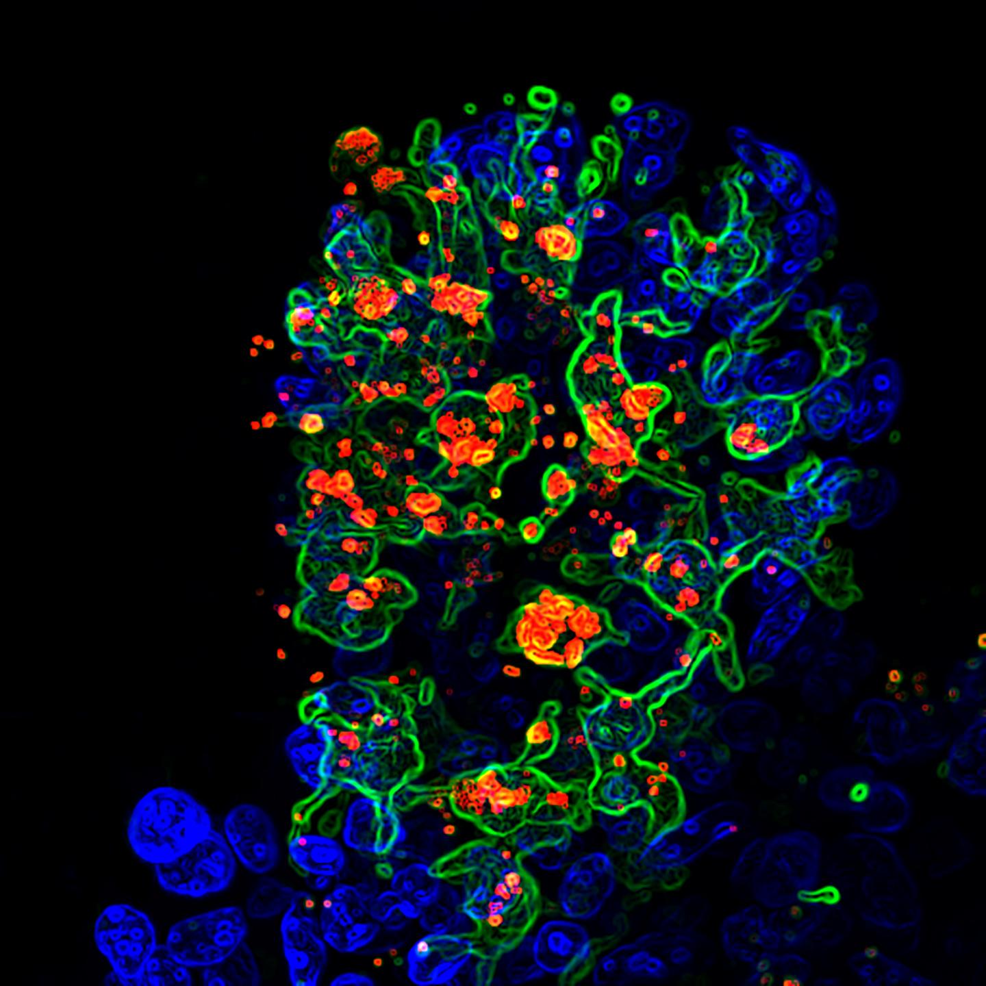 Opportunistic Fungus Called Candida albicans (Red) Engulfed by CX3CR1+ Phagocytes (Green)