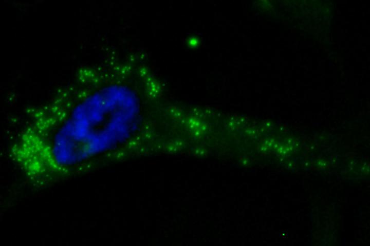 Study Unveils New Way to Starve Tumors to Death