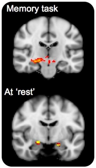 Brain Network Activity for APOE4 Carriers and Non-Xarriers