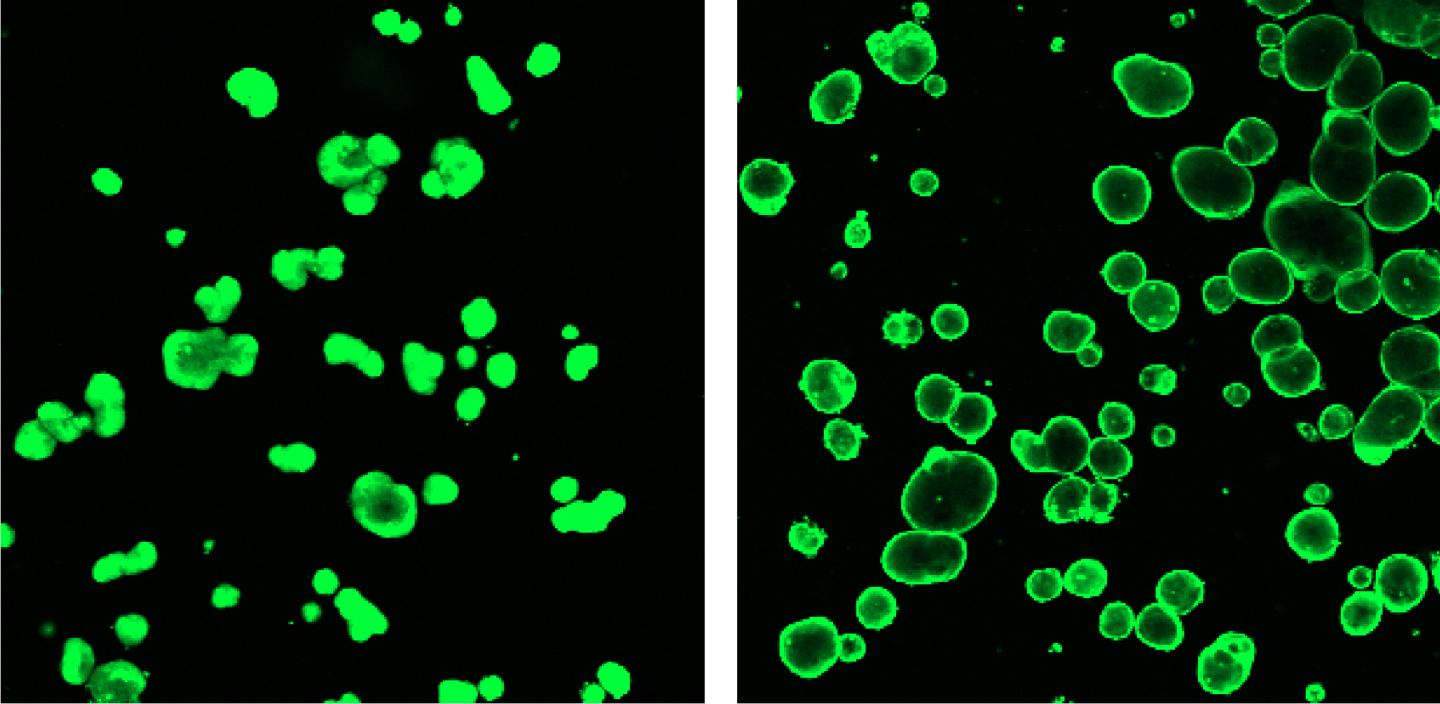 Cystic Fibrosis Organoids, with a Mutation in CFTR (Left) and Repaired (Right)