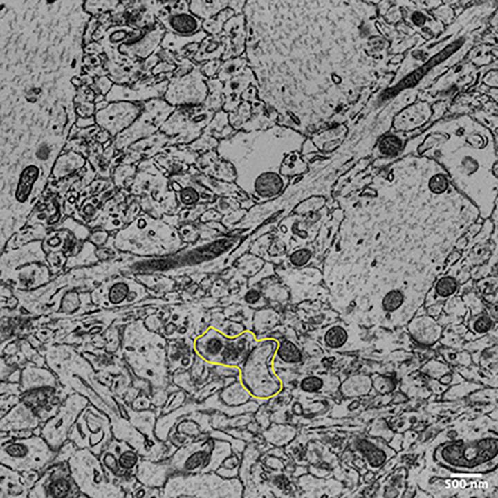 Peering into the brain, one synapse at a time