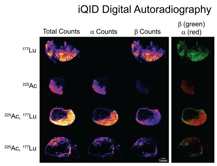 Autoradiography Images Of GPA3 [IMAGE] | EurekAlert! Science News Releases