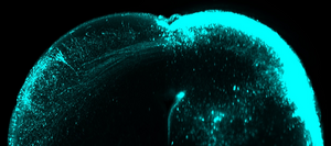 Optical coronal sections from 3D light-sheet images showing EGFP lentiviral labelled axons in the superficial superior colliculus (sSC) of a control E18 mouse_