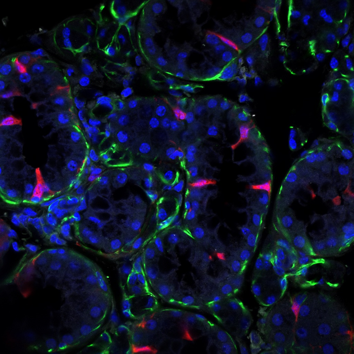 Newly identified cell type could be the key to restoring damaged salivary glands