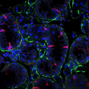 Newly identified cell type could be the key to restoring damaged salivary glands