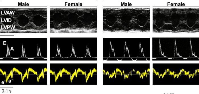 Doppler echocardiographic images in male and female mice