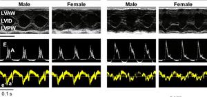 Doppler echocardiographic images in male and female mice