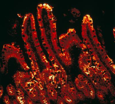 Enzyme Responsible for the Final Reaction in Intestinal Glucose Production