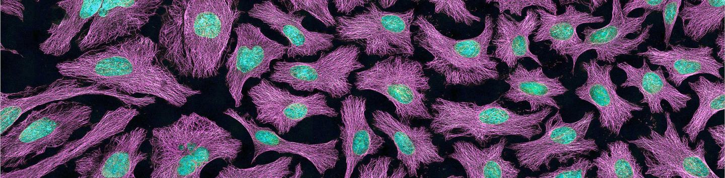 HeLa cells