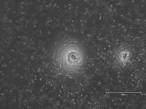 Using phase field equations to model cell aggregation