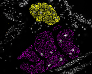 Localization of the two bacterial symbionts