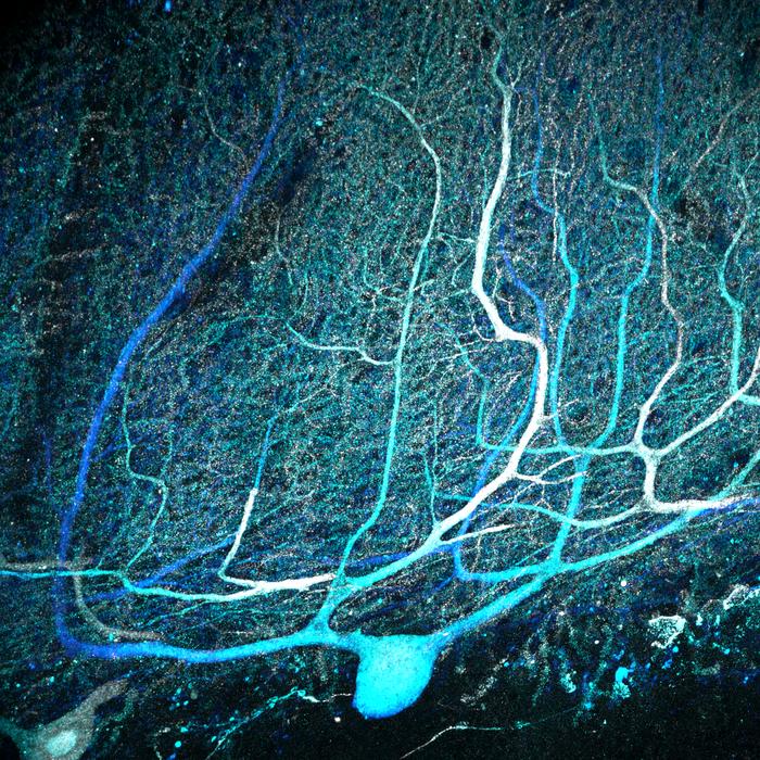 Human Purkinje cells