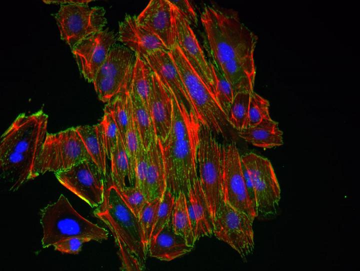 Epithelial Breast Cancer Cells Following Treatment With an EMT Activator