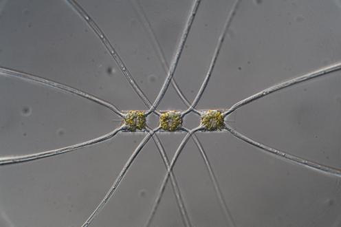 <em>Chaetoceros atlanticus</em>