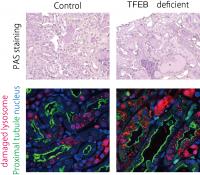 Figure 2. Functional TFEB is required to prevent the progression of crystal nephropathy.