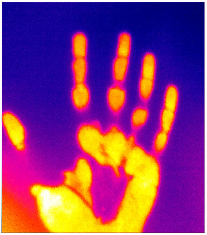 Infrared (thermal) Imaging: Hand