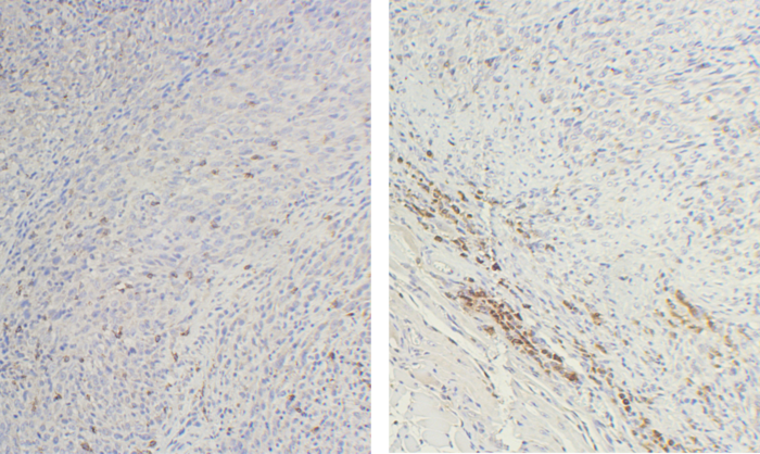 Microscopic images of mouse ovarian cancers.