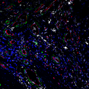 Stress Protein in Fibroblasts